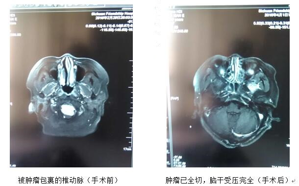 刀尖上的舞蹈