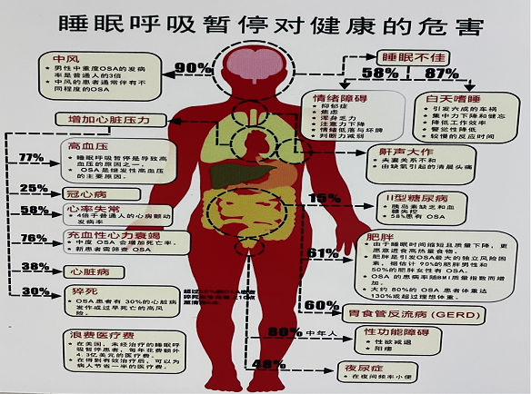 睡眠殺手――阻塞性睡眠呼吸暫停綜合征是個(gè)什么病