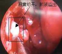 耳鼻咽喉科的“跨界行動”