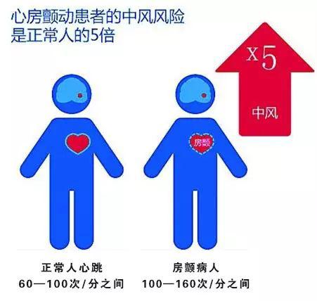 房顫與中風(fēng)―警惕房顫，從中年開始！