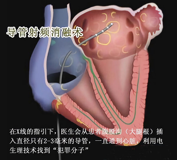 圖片12.png