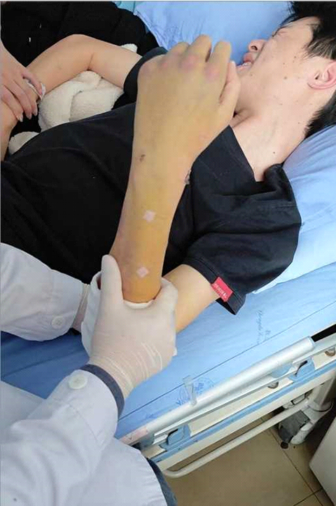 術(shù)后功能鍛煉快速康復(fù)