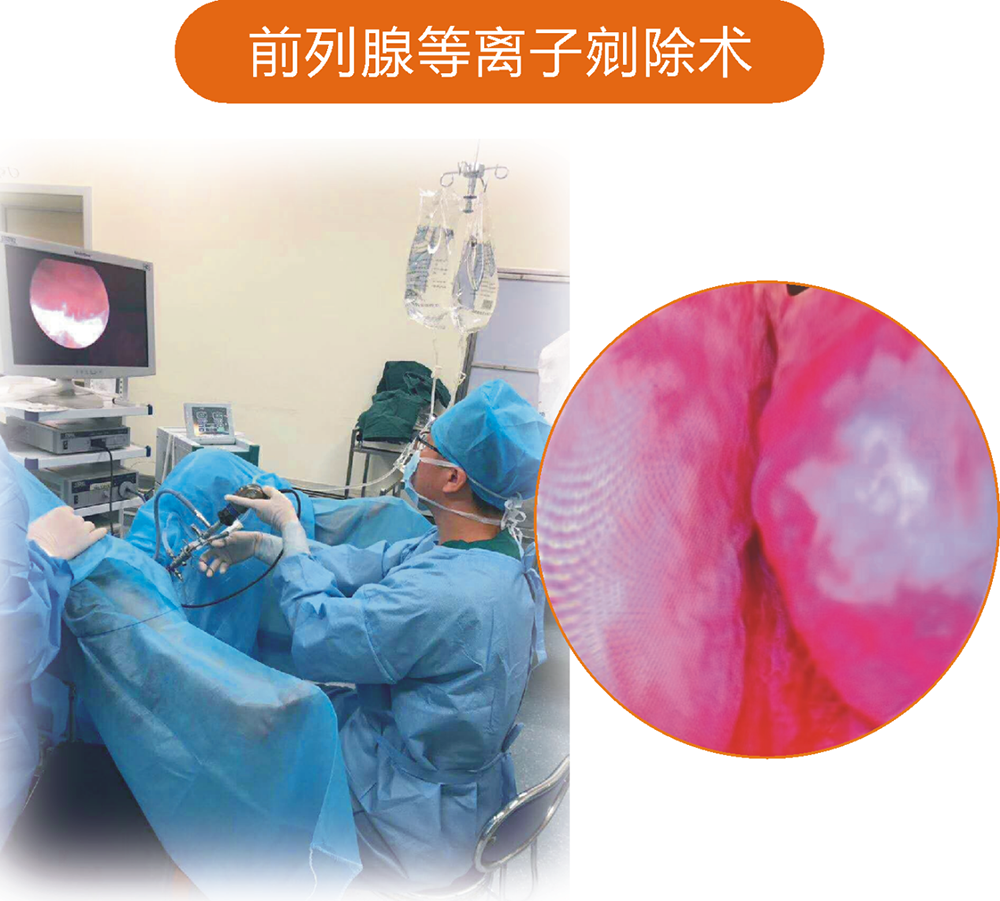 腹腔鏡微創(chuàng)技術(shù)的應(yīng)用