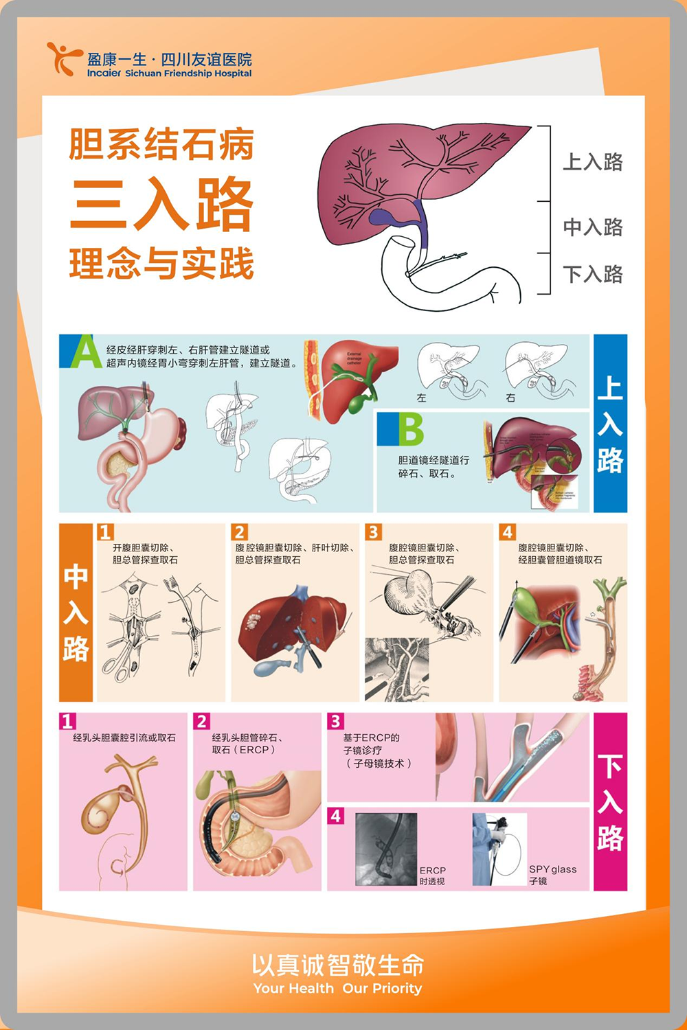 膽系結(jié)石病三入路理念與實(shí)踐