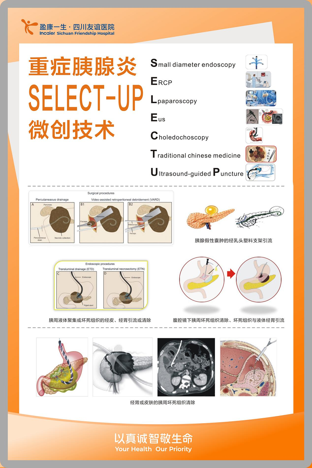 重癥胰腺炎SELECT-UP微創(chuàng)技術(shù)