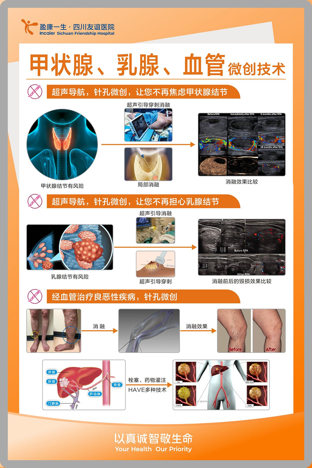 甲狀腺、乳腺、血管微創(chuàng)技術(shù)