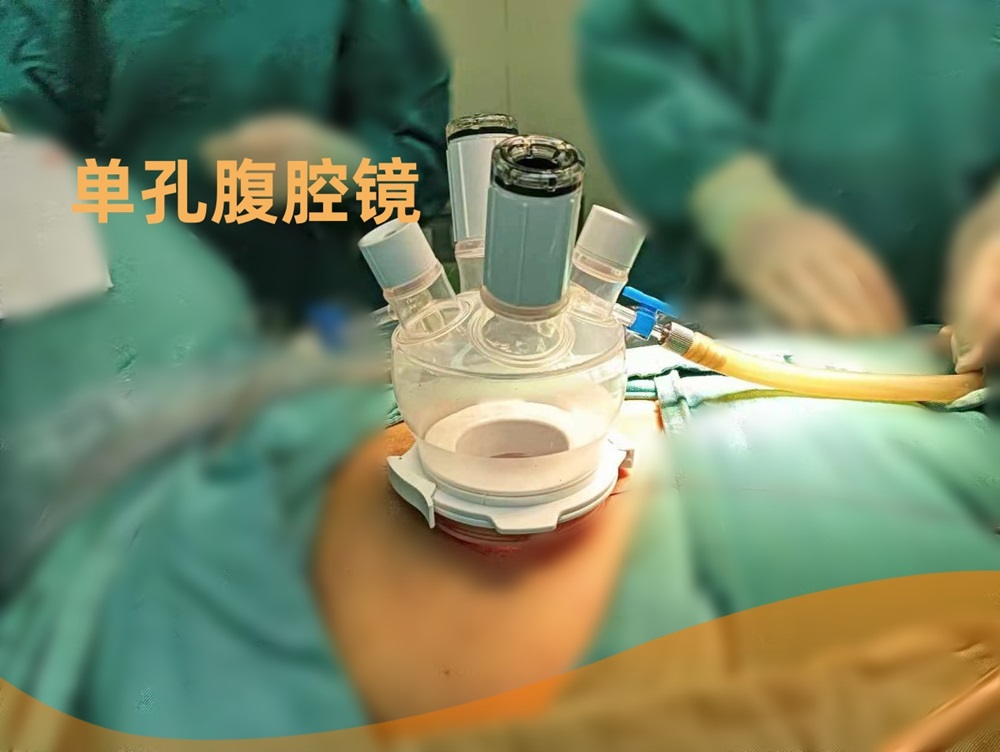 技術(shù)突破：盈康一生四川友誼醫(yī)院連續(xù)開展單孔腹腔鏡、單孔胸腔鏡切除術(shù)